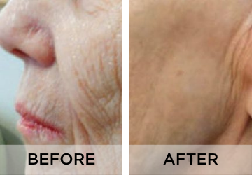 anti-aging-before-and-after