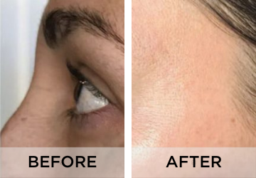 Pigmentation-before-and-after-1.png