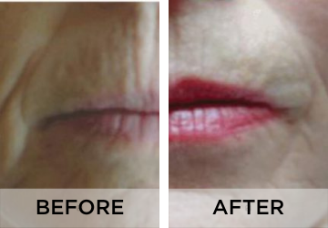 anti-aging-before-and-after-1.png